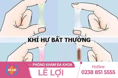 Các bệnh khí hư thường gặp dấu hiệu và cách điều trị
