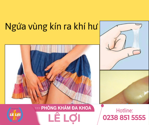 Ngứa Rát Ra Nhiều Khí Hư Là Bị Bệnh Gì?