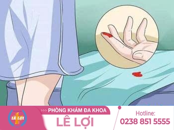 Chảy máu vùng kín nguy hiểm không?