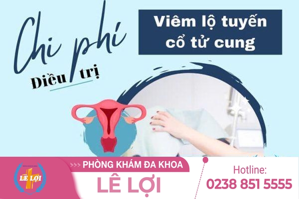 Chi phí trị viêm lộ tuyến bao nhiêu?