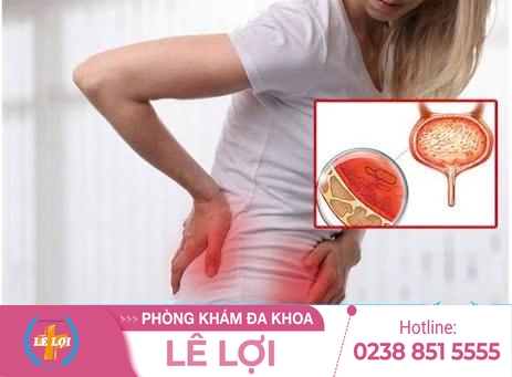 Nguyên Nhân Đau Bàng Quang Ở Nữ Và Cách Khắc Phục