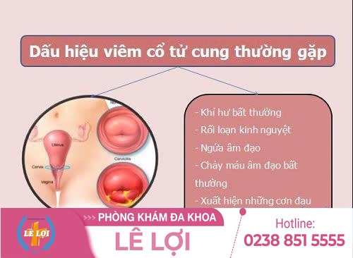 Dấu hiệu viêm tử cung chị em cần biết