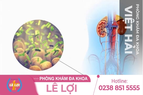 Đau Niệu Đạo Ở Nữ – Dấu Hiệu Bệnh Viêm Đường Tiết Niệu