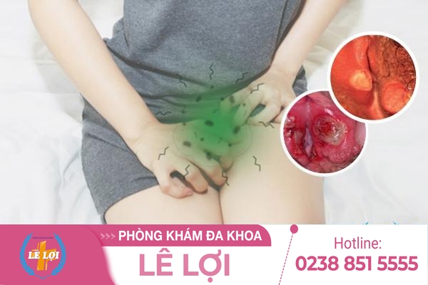 lo-loet-vung-kin (1)