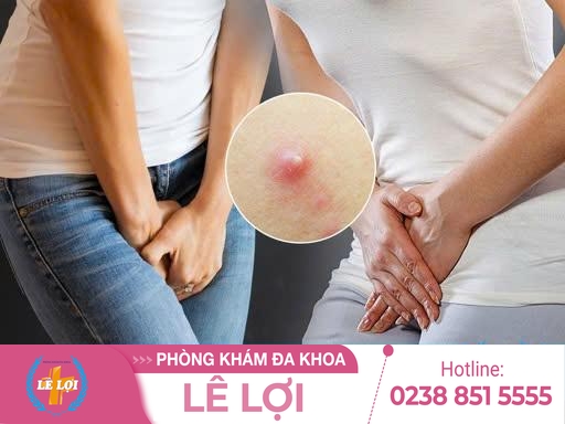Nổi mụn mủ ở âm đạo điều trị cách nào nhanh hết?