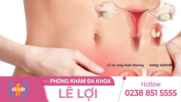 Những điều bạn cần biết về nang naboth cổ tử cung