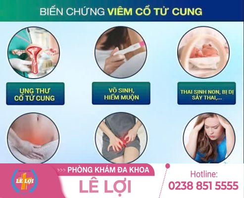 Viêm Cổ Tử Cung Nguy Hiểm Như Thế Nào?