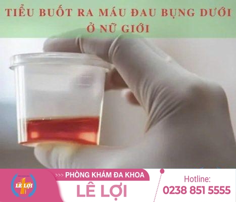 Tiểu ra máu ở nữ là bị làm sao?