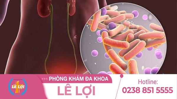 Địa Chỉ Khám Viêm Bàng Quang Ở Nữ Uy Tín Tại Nghệ An