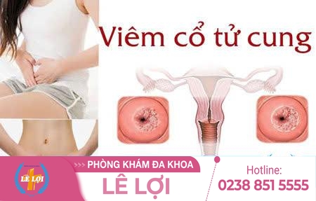 Chi phí điều trị viêm cổ tử cung bao nhiêu?