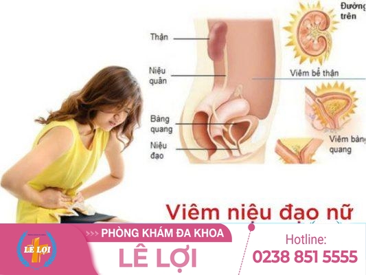 Phương Pháp Điều Trị Viêm Niệu Đạo Nữ Hiệu Quả
