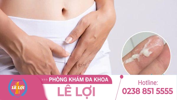 Mảng bám âm hộ, mảng bám vùng kín là bị bệnh gì?