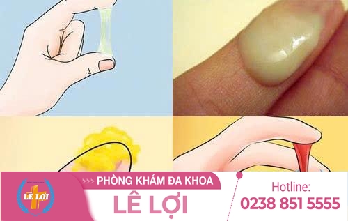 Cách trị huyết trắng ở phụ nữ