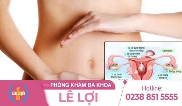 Tức bụng dưới ở phụ nữ là bệnh gì?