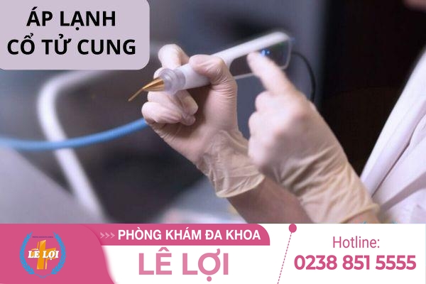 Giá áp lạnh cổ tử cung hiện nay bao nhiêu?