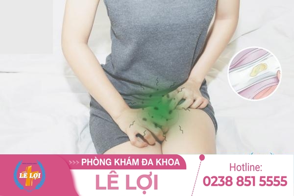Vùng kín ra dịch có mùi hôi, mùi tanh là bị bệnh gì?
