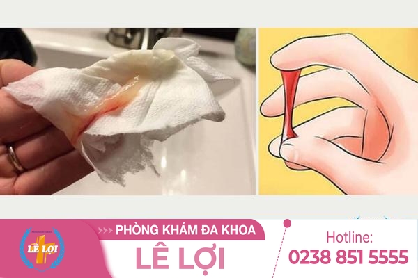 Huyết trắng có máu là bị bệnh gì?