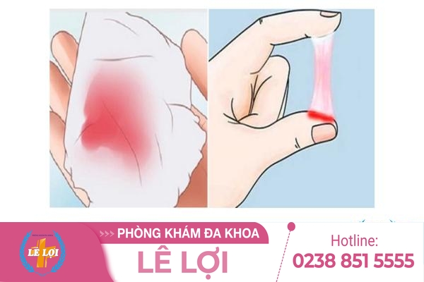 Khí hư màu hồng là dấu hiệu bệnh gì?