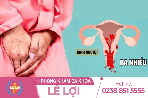 Kinh nguyệt ra nhiều có ảnh hưởng gì không?