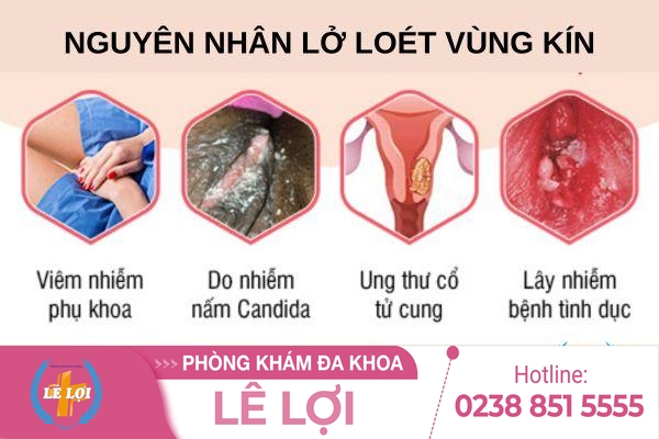 Lở loét âm đạo do những nguyên nhân nào?