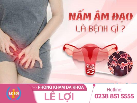 Cách chữa nấm âm đạo hiệu quả hiện nay