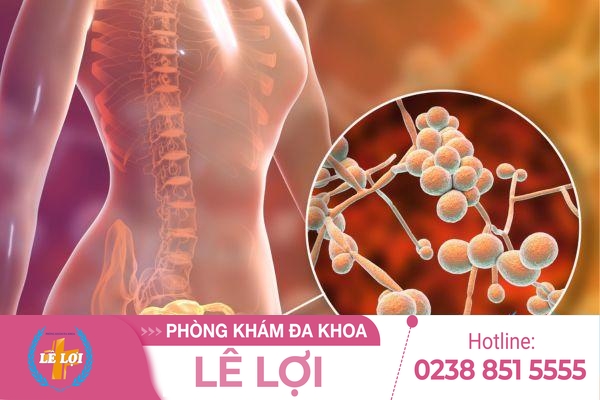 Cách điều trị nấm phụ khoa hiệu quả