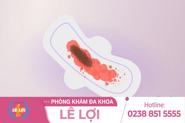 Giải Mã Tình Trạng Rong Kinh – Đừng Chủ Quan Với Cơ Thể Mình