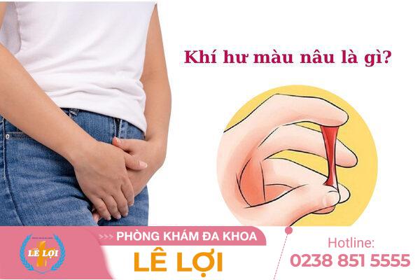 Khí hư màu nâu bất thường – Chuyên gia phụ khoa cảnh báo nguyên nhân