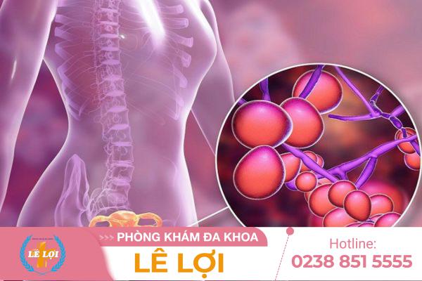 Làm sao để thoát khỏi nỗi ám ảnh nấm vùng kín?