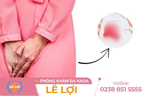 Dịch Âm Đạo Màu Hồng: Hiện Tượng Bình Thường Hay Dấu Hiệu Bất Thường?